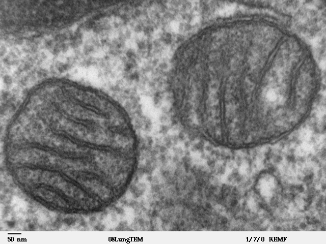 難病「ミトコンドリア病」に効果ある新化合物「ＭＡ−５」発見　世界初の新薬開発に期待