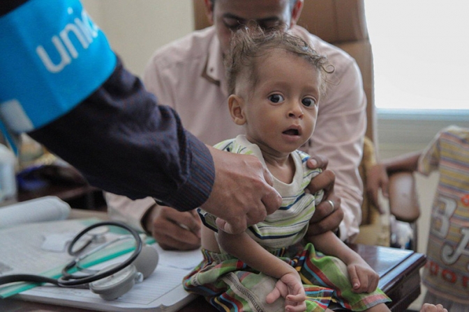イエメン危機、４人に３人が支援必要　子ども２２０万人が急性栄養失調に