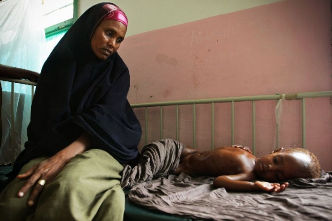 ソマリア首都モガディシオの病院で治療を受けるのを待つ栄養失調の子ども。２０１１年８月１０日（写真提供:国際連合）   